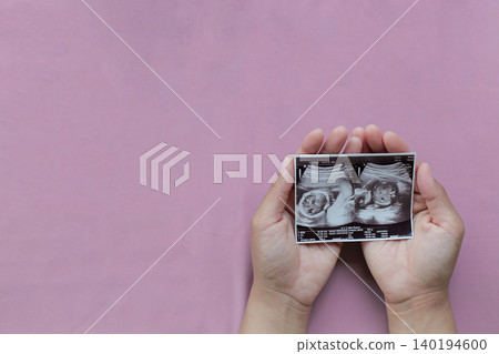 Soft pink background highlights tender hands holding ultrasound photo. Fingers cradle precious baby image, face and hands clearly visible. Moments of joy, wonder, and anticipation captured in simple Soft pink background highlights tender hands holding ultrasound photo. Fingers cradle precious baby image, face and hands clearly visible. Moments of joy, wonder, and anticipation captured in simple 140194600