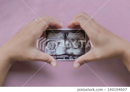 Soft pink background highlights tender hands holding ultrasound photo. Fingers cradle precious baby image, face and hands clearly visible. Moments of joy, wonder, and anticipation captured in simple Soft pink background highlights tender hands holding ultrasound photo. Fingers cradle precious baby image, face and hands clearly visible. Moments of joy, wonder, and anticipation captured in simple 140194607
