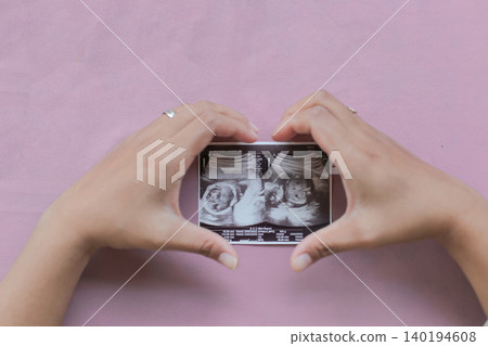Soft pink background highlights tender hands holding ultrasound photo. Fingers cradle precious baby image, face and hands clearly visible. Moments of joy, wonder, and anticipation captured in simple Soft pink background highlights tender hands holding ultrasound photo. Fingers cradle precious baby image, face and hands clearly visible. Moments of joy, wonder, and anticipation captured in simple 140194608