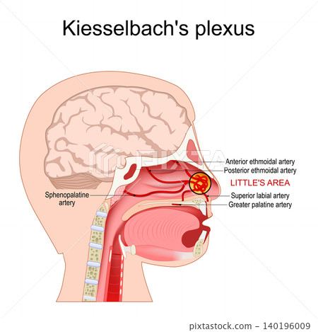 Kiesselbachs plexus. Anastomotic arterial network for nosebleeds. Kiesselbachs plexus. Anastomotic arterial network for nosebleeds. 140196009