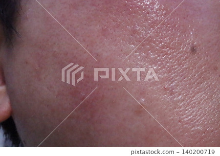 Close-up of Human Skin Texture 140200719