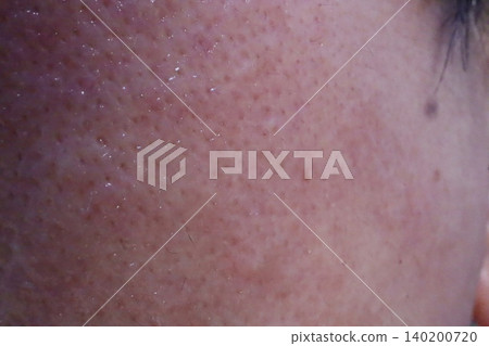 Close-up of Human Skin Texture Close-up of Human Skin Texture 140200720