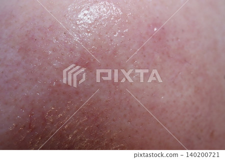 Close-up of Human Skin Texture with Pores and Oil Close-up of Human Skin Texture with Pores and Oil 140200721