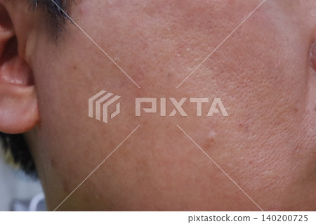 Close-up of Human Skin and Ear Close-up of Human Skin and Ear 140200725