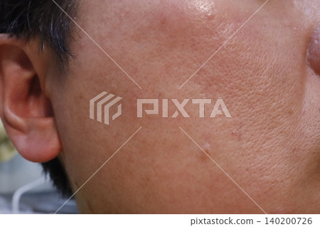 Close-up of Human Skin Near Ear Close-up of Human Skin Near Ear 140200726