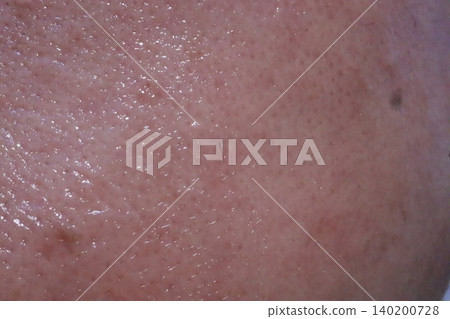 Close-Up of Human Skin Texture Close-Up of Human Skin Texture 140200728