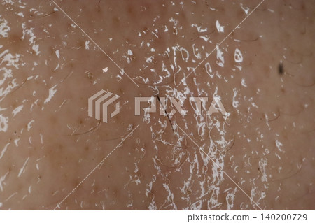 Close-up of Human Skin Texture with Hair and Flakes 140200729