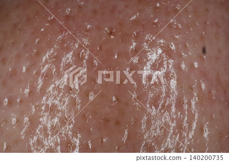 Close-up of Human Skin Texture 140200735