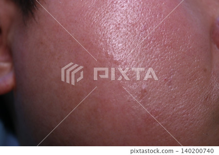 Close-up of Human Skin Texture Close-up of Human Skin Texture 140200740
