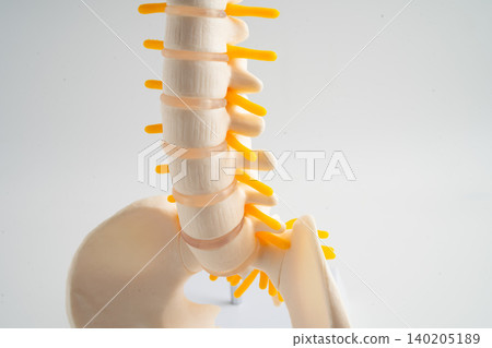 Lumbar spine displaced herniated disc fragment, spinal nerve and bone. Model for treatment medical in the orthopedic department. Lumbar spine displaced herniated disc fragment, spinal nerve and bone. Model for treatment medical in the orthopedic department. 140205189