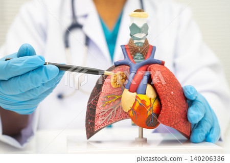 Pneumonia, lung cancer, Asian doctor holding human anatomy model for study diagnosis and treatment in hospital. Pneumonia, lung cancer, Asian doctor holding human anatomy model for study diagnosis and treatment in hospital. 140206386