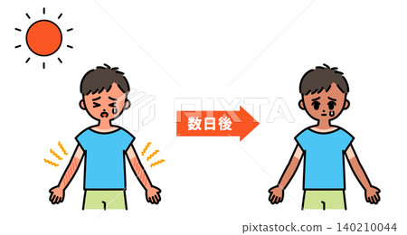 An illustration illustrating the passage of time due to sunburn. An illustration illustrating the passage of time due to sunburn. 140210044