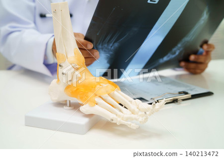 Doctor examining foot ankle joint bone radiography xray film. Doctor examining foot ankle joint bone radiography xray film. 140213472