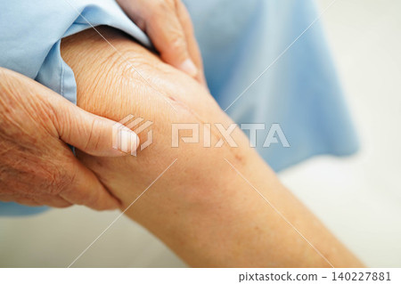 Asian elderly woman patient with scar knee replacement surgery in hospital. 140227881