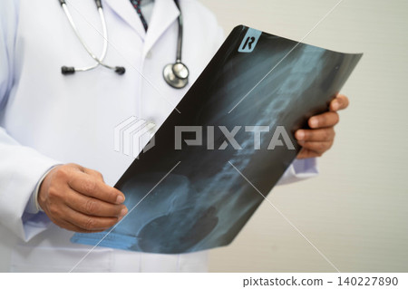 Doctor examining spine bone radiography xray film. Doctor examining spine bone radiography xray film. 140227890