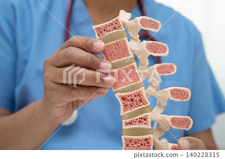Doctor holding osteoporosis in back bone model for treatment medical in orthopedic department. 140228315