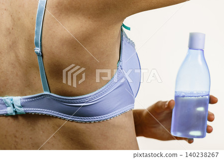 Woman acne on back cleaning skin with cotton 140238267