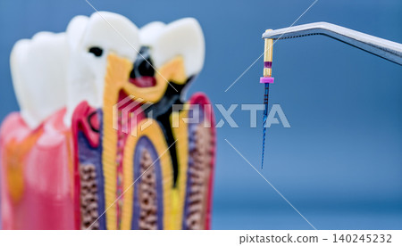 Macro view of endodontic rotary file in tweezers with blurred cross-section tooth model in background. Root canal treatment concept. Macro view of endodontic rotary file in tweezers with blurred cross-section tooth model in background. Root canal treatment concept. 140245232