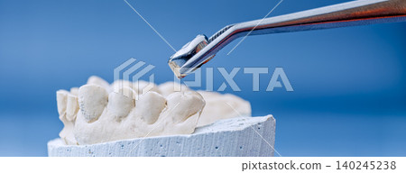 Dental web banner: Tweezers holding metal tooth crown over a plaster jaw model with copy space. Dental web banner: Tweezers holding metal tooth crown over a plaster jaw model with copy space. 140245238