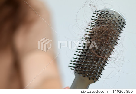 Close-up of a hairbrush full of lost hair after combing. Hair loss problem, alopecia, or shedding concept with a blurred woman holding a brush on a bright background 140263899