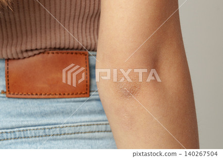 Close view of a persons elbow and part of their outfit in a simple indoor setting 140267504