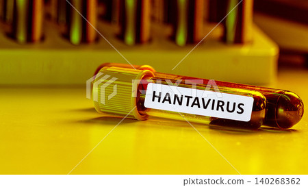 Hantavirus labeled test tube on a laboratory bench with other tubes in background Hantavirus labeled test tube on a laboratory bench with other tubes in background 140268362