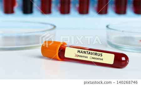 Testing blood samples for hantavirus at a laboratory in the evening 140268746