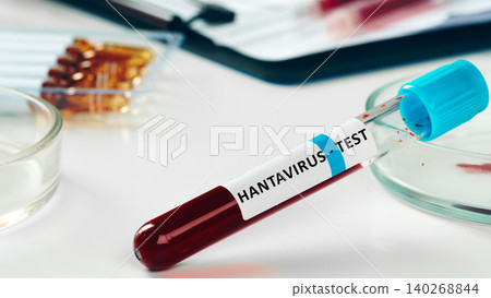 Testing for hantavirus in a laboratory with blood samples and medical equipment 140268844