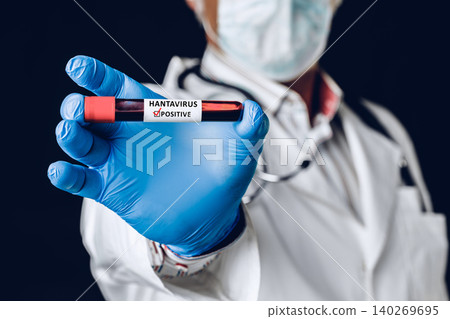 Healthcare worker holds hantavirus positive blood sample in laboratory setting 140269695