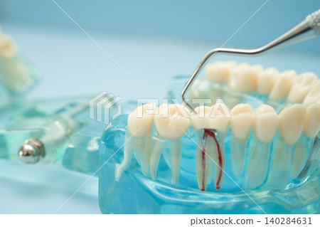 Dental teeth model with dentist tool for dentistry. Dental teeth model with dentist tool for dentistry. 140284631