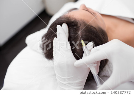 treatment of hair loss, injection for hair growth. Injected in woman's head, hair mesotherapy treatment of hair loss, injection for hair growth. Injected in woman's head, hair mesotherapy 140287772