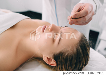 Acupuncturist inserting a needle into a female face 140287945