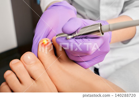 Patient having laser treatment fungal infection on toenail, close-up. Onychomycosis treatment with a medical laser at a clinic Patient having laser treatment fungal infection on toenail, close-up. Onychomycosis treatment with a medical laser at a clinic 140288720