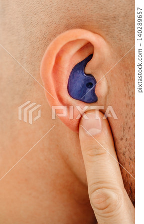 Personally molded earplugs for use in airplane at high atmospheric pressure with pressure valve. Comfortable flight of a person with earplugs for an airplane Personally molded earplugs for use in airplane at high atmospheric pressure with pressure valve. Comfortable flight of a person with earplugs for an airplane 140289657