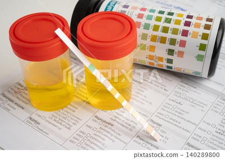 Urinalysis, urine cup with reagent strip pH paper test and comparison chart in laboratory. 140289800