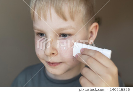 Cute 10 years old boy applying mineral sunscreen stick on his face. Caucasian child protecting freckled skin from sun damage with spf stick at home. 140316836