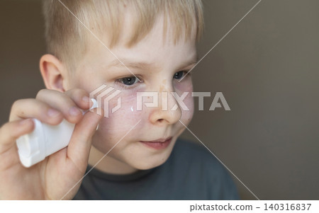 Cute 10 years old boy applying mineral sunscreen stick on his face. Caucasian child protecting freckled skin from sun damage with spf stick at home. 140316837