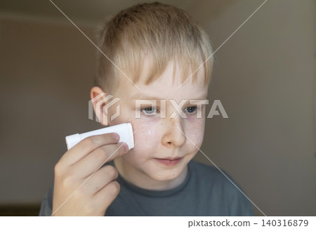 Cute 10 years old boy applying mineral sunscreen stick on his face. Caucasian child protecting freckled skin from sun damage with spf stick at home. 140316879