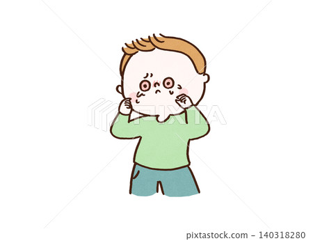 A man's eyes became bright red and bloodshot due to itching (hay fever/allergy). A man's eyes became bright red and bloodshot due to itching (hay fever/allergy). 140318280