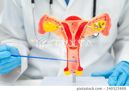 Doctor holding human uterus model for vaginal and cervix pap smear check up in the obstetrics and gynecology. Doctor holding human uterus model for vaginal and cervix pap smear check up in the obstetrics and gynecology. 140325989