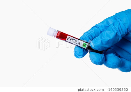 Ebola Virus Blood Sample Test Tube in Gloved Hand Ebola Virus Blood Sample Test Tube in Gloved Hand 140339260