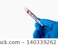 Tick borne Encephalitis Blood Sample Test Tube 140339262
