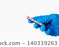 Lyme Disease Positive Blood Test Tube 140339263