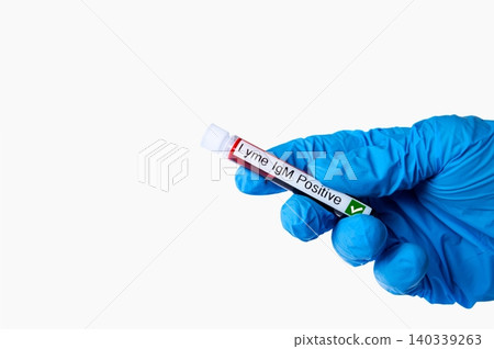 Lyme Disease Positive Blood Test Tube Lyme Disease Positive Blood Test Tube 140339263
