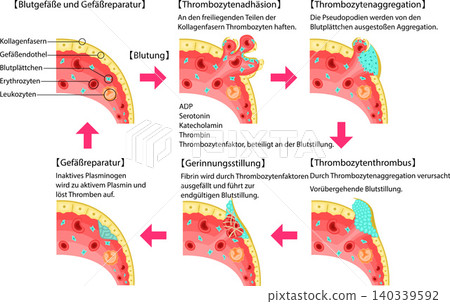 Schematic diagram of the process from vascular injury to hemostasis, blood coagulation, and vascular repair (in German) 140339592