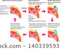 Schematic diagram of the process from vascular injury to hemostasis, blood coagulation, and vascular repair (English diagram) 140339593