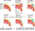 Schematic diagram of the process from vascular injury to hemostasis, blood coagulation, and vascular repair (Japanese diagram) 140339594