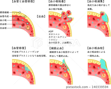 血管損傷至止血、血液凝固及血管修復過程示意圖(日文圖) 血管損傷至止血、血液凝固及血管修復過程示意圖(日文圖) 140339594
