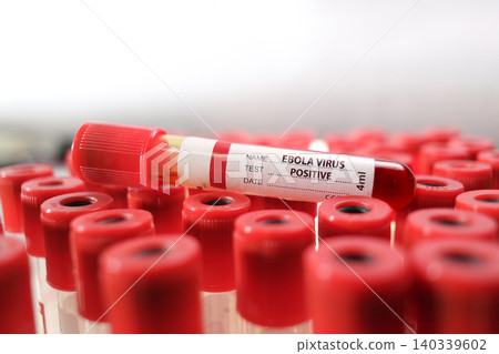Ebola Virus Positive Blood Sample Ebola Virus Positive Blood Sample 140339602