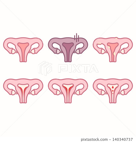 Uterus and Gynecology Health Problems Vector Icon Set 140340737